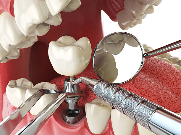 Best Cracked Tooth Emergency Dentist  in Alvord, TX